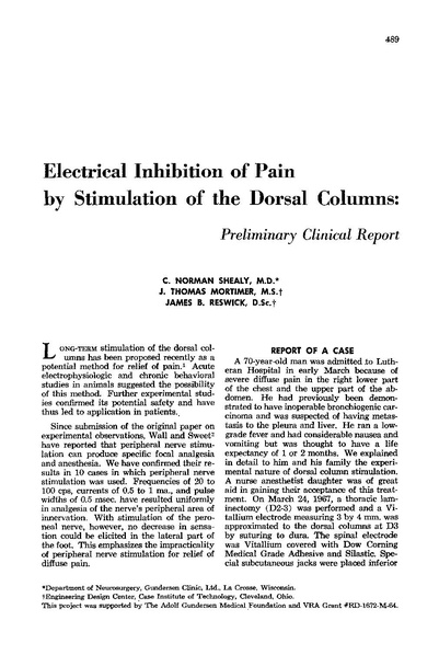 File:Electrical Inhibition of Pain by Stimulation of Dorsal Columns.pdf
